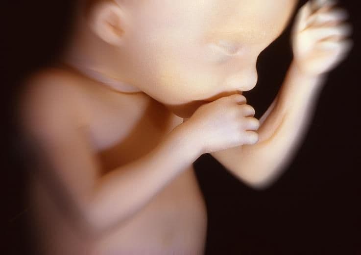 Ultrasound image at pregnancy week 22