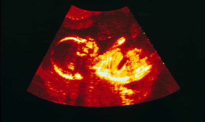 23 weeks and 2 days pregnant