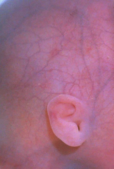 24 weeks and 2 days pregnant