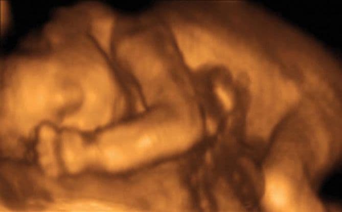 24 weeks and 3 days pregnant