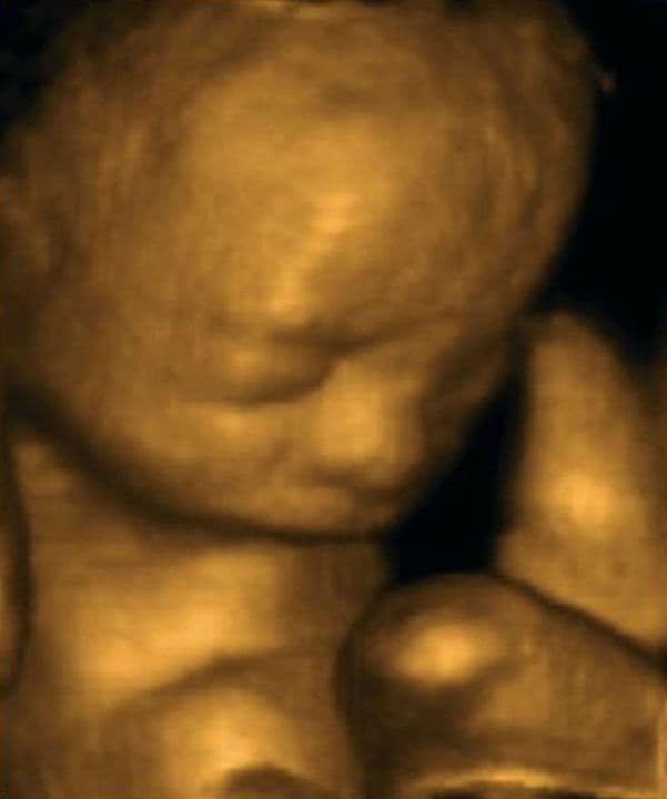 24 weeks and 7 days pregnant