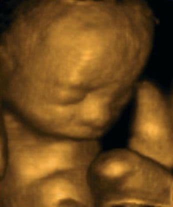 24 weeks and 7 days pregnant