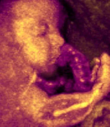 25 weeks and 2 days pregnant