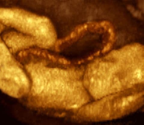 26 weeks and 1 day pregnant
