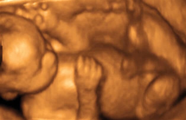 27 weeks and 7 days pregnant