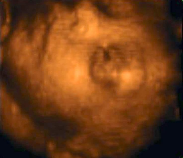 28 weeks and 3 days pregnant