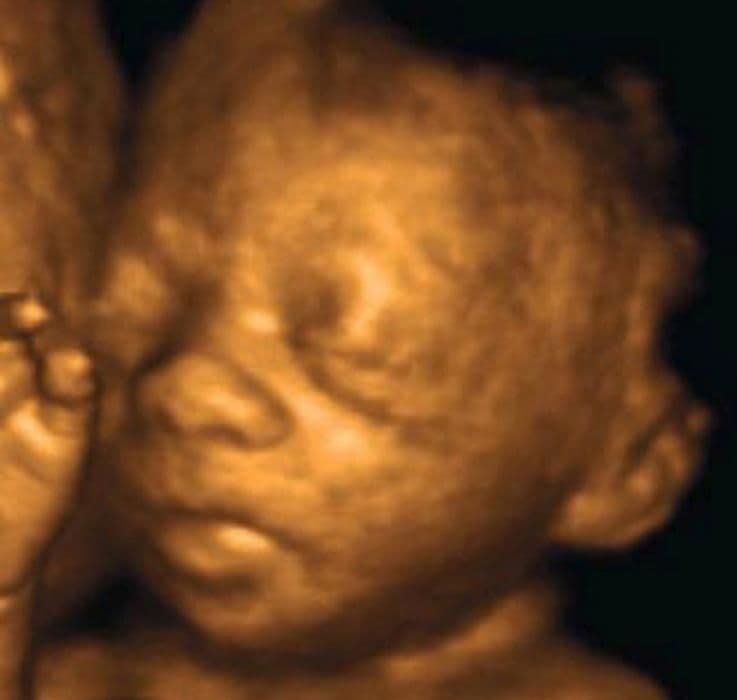 28 weeks and 5 days pregnant