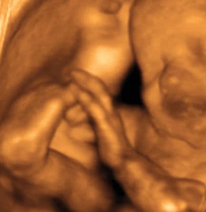 29 weeks and 3 days pregnant