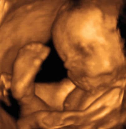 29 weeks and 6 days pregnant