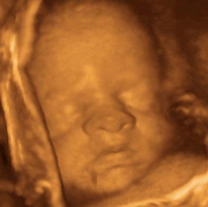 30 weeks and 4 days pregnant