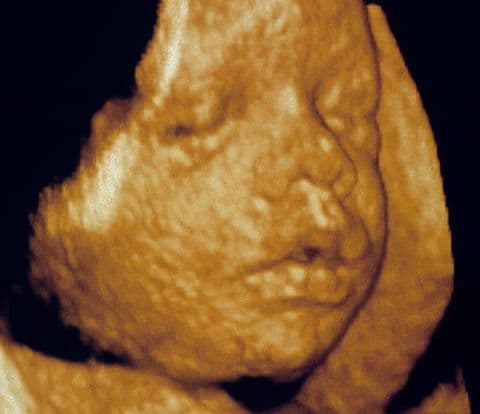 31 weeks and 1 day pregnant