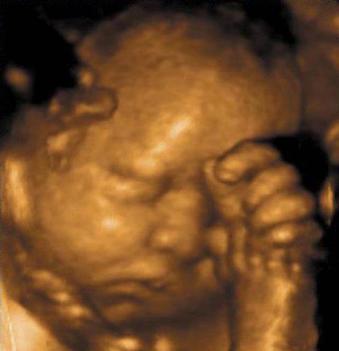 31 weeks and 3 days pregnant