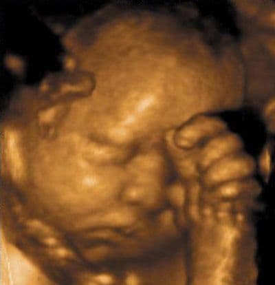 31 weeks and 3 days pregnant
