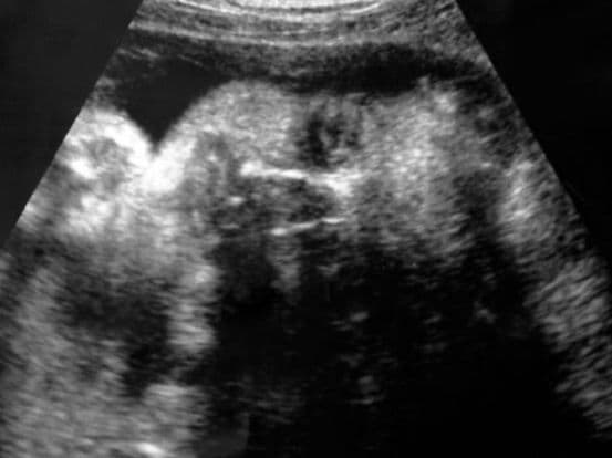 31 weeks and 4 days pregnant