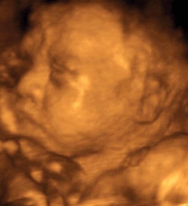 31 weeks and 5 days pregnant
