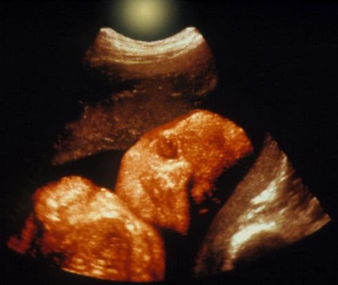 31 weeks and 6 days pregnant