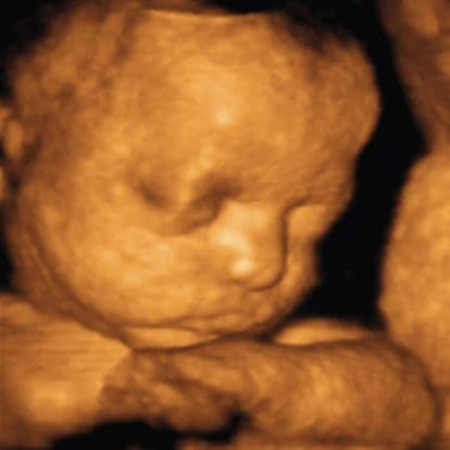 32 weeks and 4 days pregnant