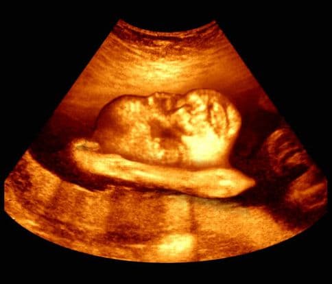 32 weeks and 5 days pregnant
