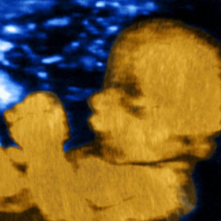 Ultrasound image at pregnancy week 33