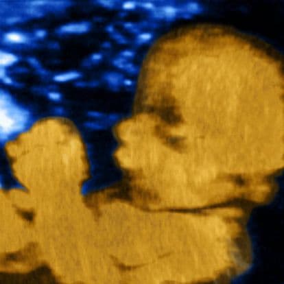 33 weeks and 1 day pregnant