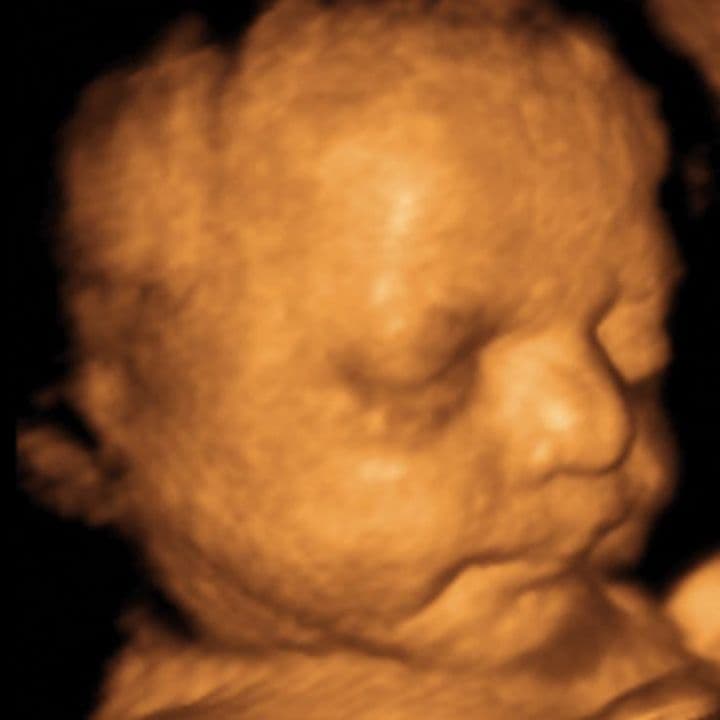 33 weeks and 3 days pregnant