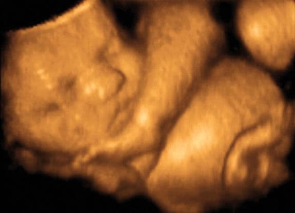 33 weeks and 5 days pregnant