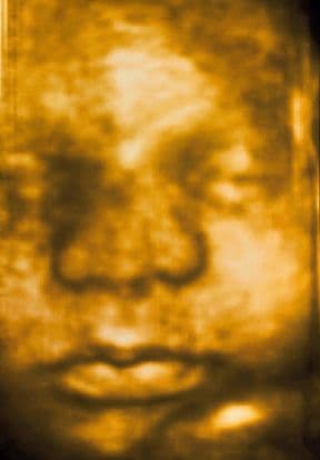 33 weeks and 7 days pregnant