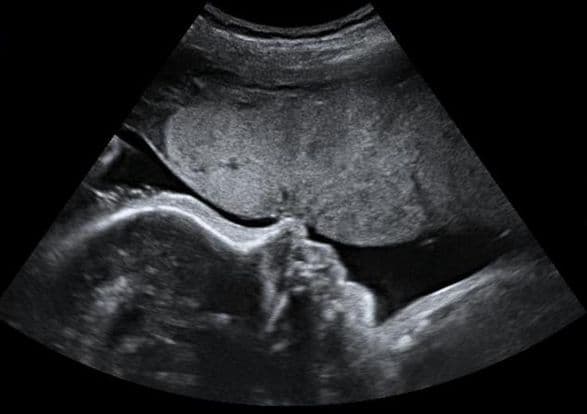 34 weeks and 1 day pregnant