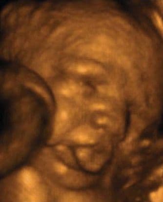 34 weeks and 3 days pregnant