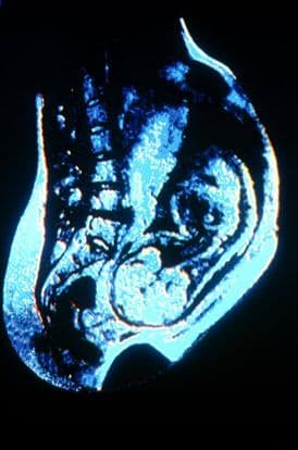 34 weeks and 5 days pregnant