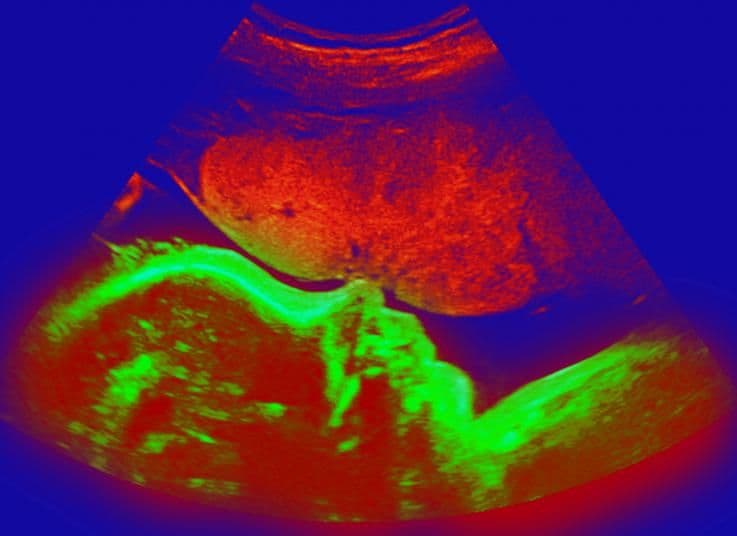 34 weeks and 6 days pregnant