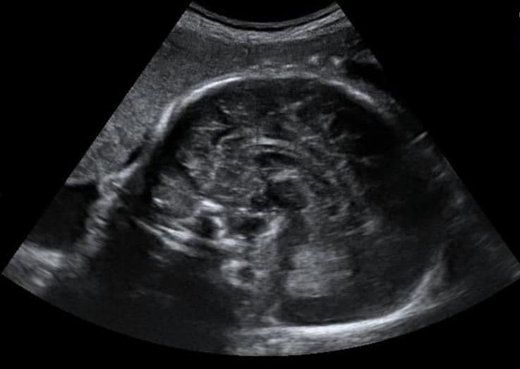 34 weeks and 7 days pregnant