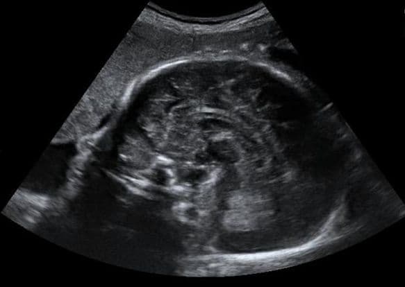 34 weeks and 7 days pregnant