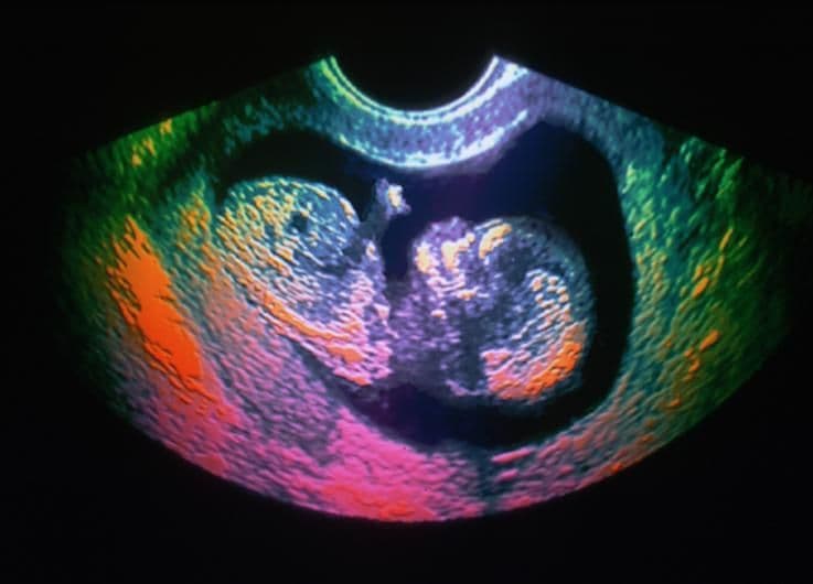 35 weeks and 3 days pregnant