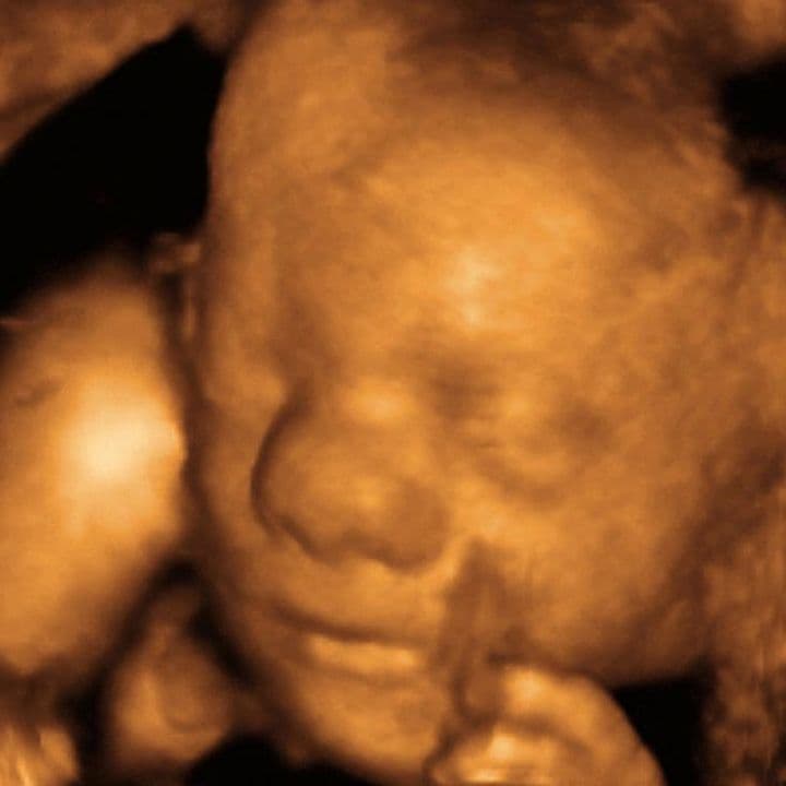 35 weeks and 4 days pregnant