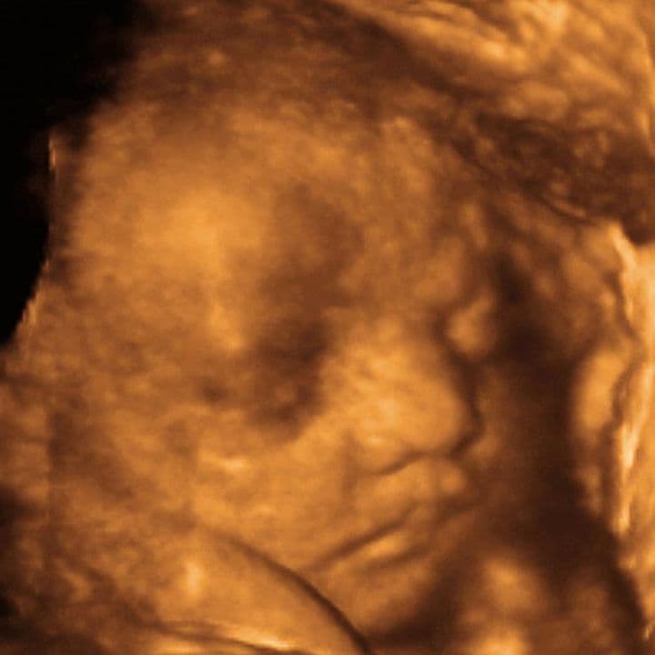 35 weeks and 5 days pregnant