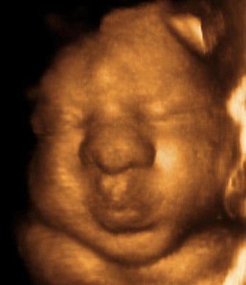 35 weeks and 6 days pregnant