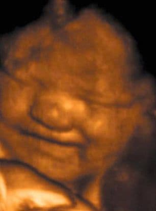36 weeks and 1 day pregnant