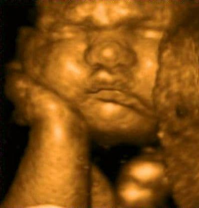 36 weeks and 3 days pregnant