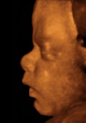 36 weeks and 5 days pregnant