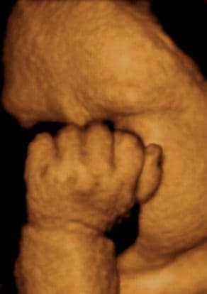 38 weeks and 1 day pregnant