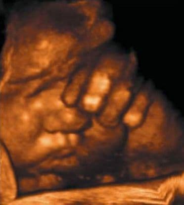 39 weeks and 3 days pregnant