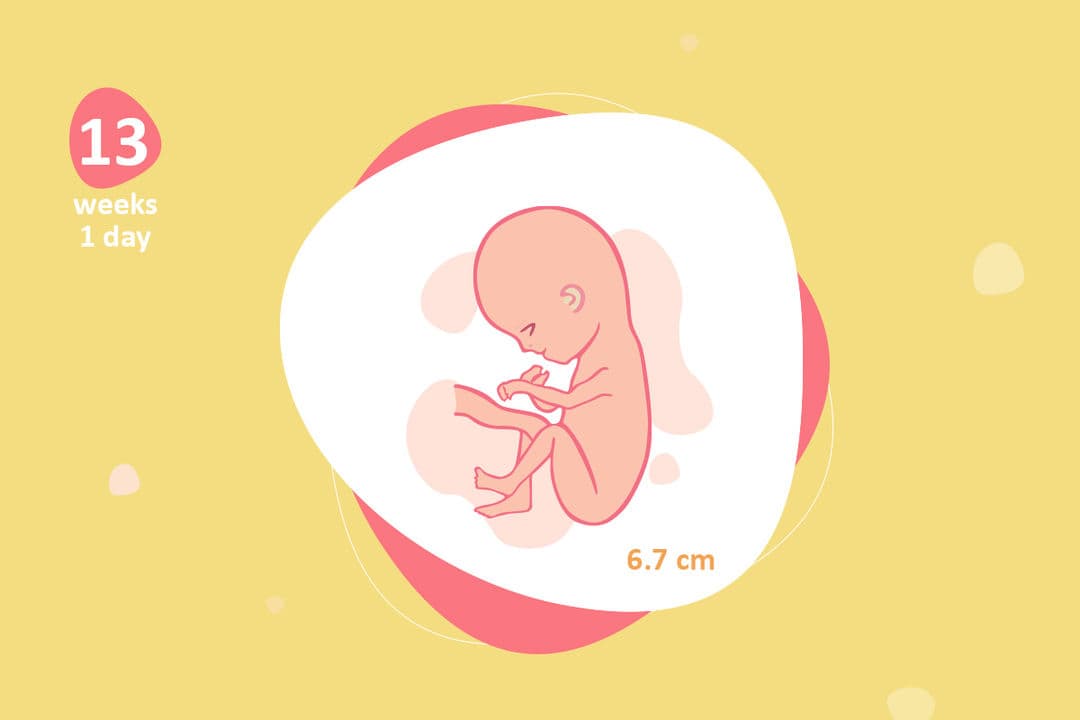 Ultrasound image at pregnancy week 13