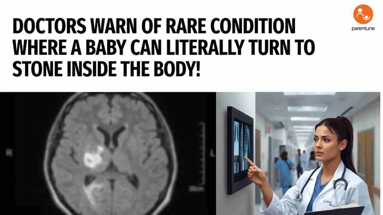 Doctors Warn of Rare Condition Where a Baby Can Literally Turn to Stone Inside the Body!
