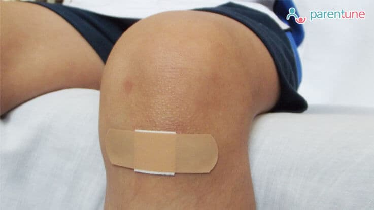 Tetanus Prevention in Children: Causes of Spread, Symptoms, Injection Doses & Treatment