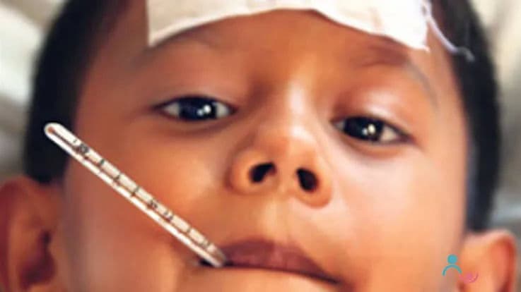 Is it Possible Prevent Febrile Convulsion? – Risks, Causes, Symptoms in Children