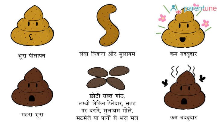 क्या बताता है बच्चे का मल आपके बच्चे के स्वास्थ्य के बारे में ?