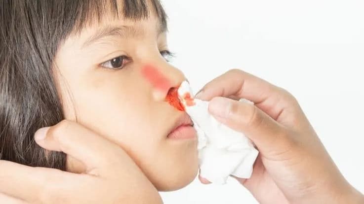 Nose Bleeding Reasons in Toddlers, How to Cure Tips, Precautions etc
