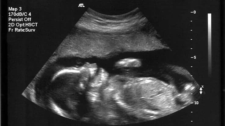 Prospective Parents can now choose the healthiest embryo: Thanks to Genetic Screening