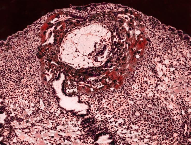 3 weeks and 1 day pregnant